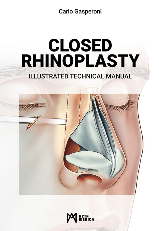 Closed rhinoplasty. Illustrated technical manual