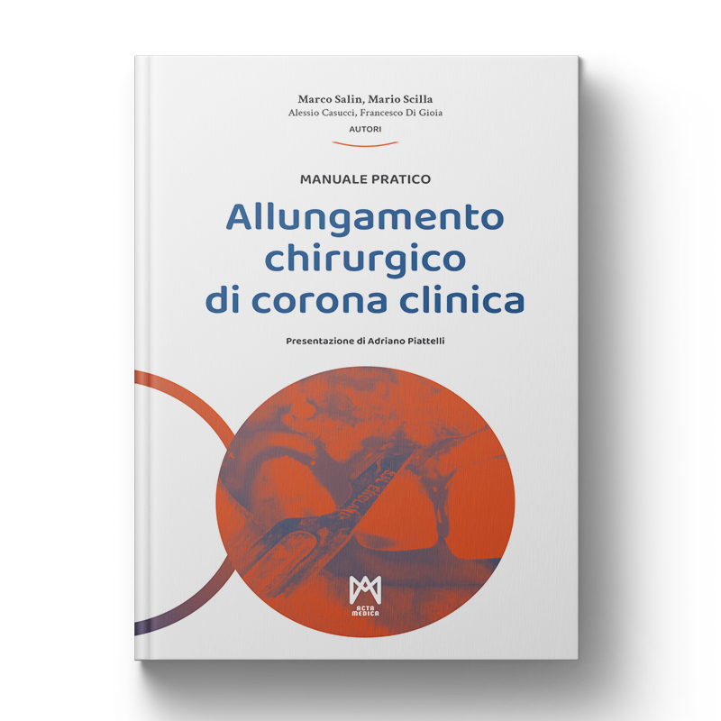 Allungamento chirurgico di corona clinica - Manuale pratico