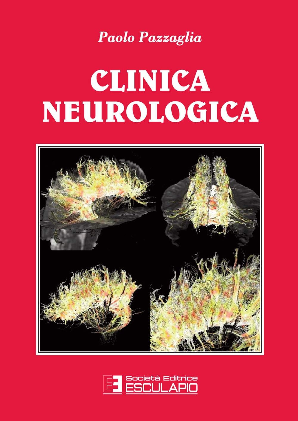 Clinica neurologica