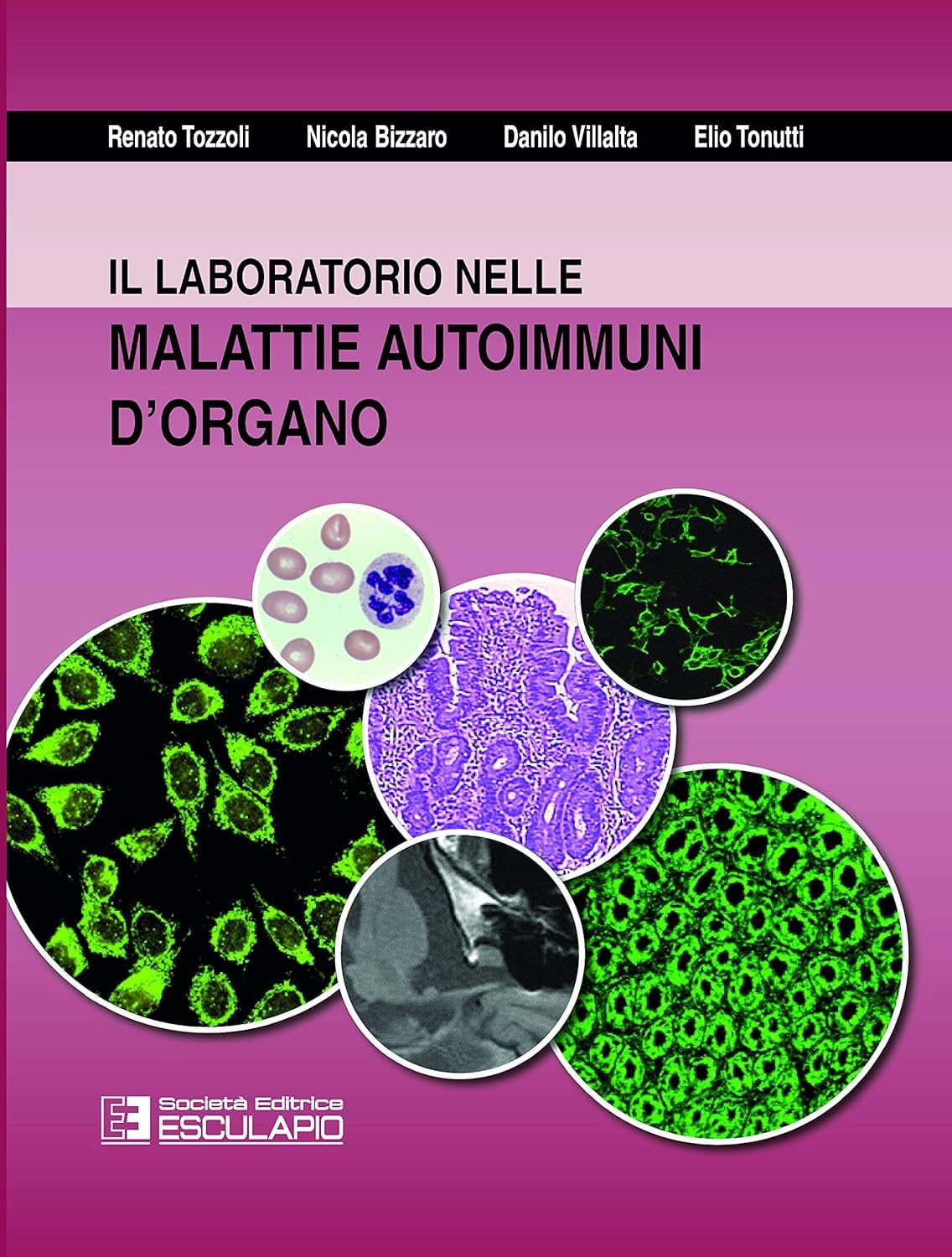 Il Laboratorio nelle malattie autoimmuni d'organo