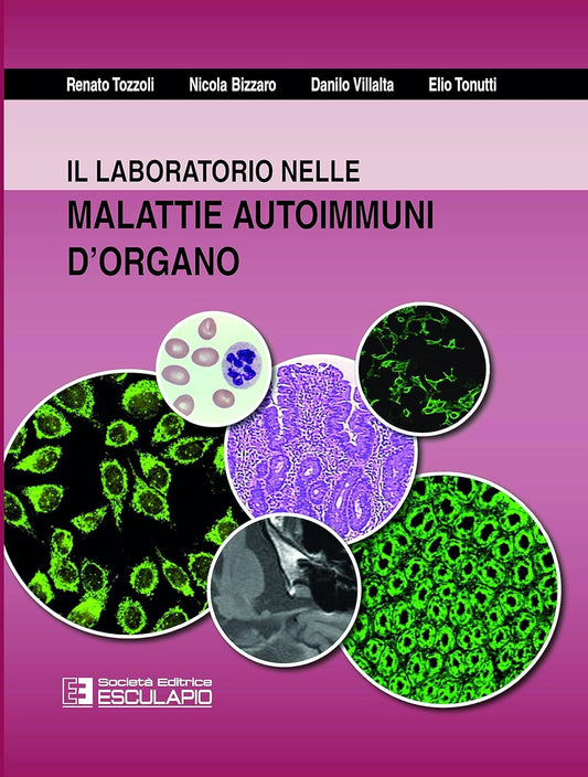 Il Laboratorio nelle malattie autoimmuni d'organo