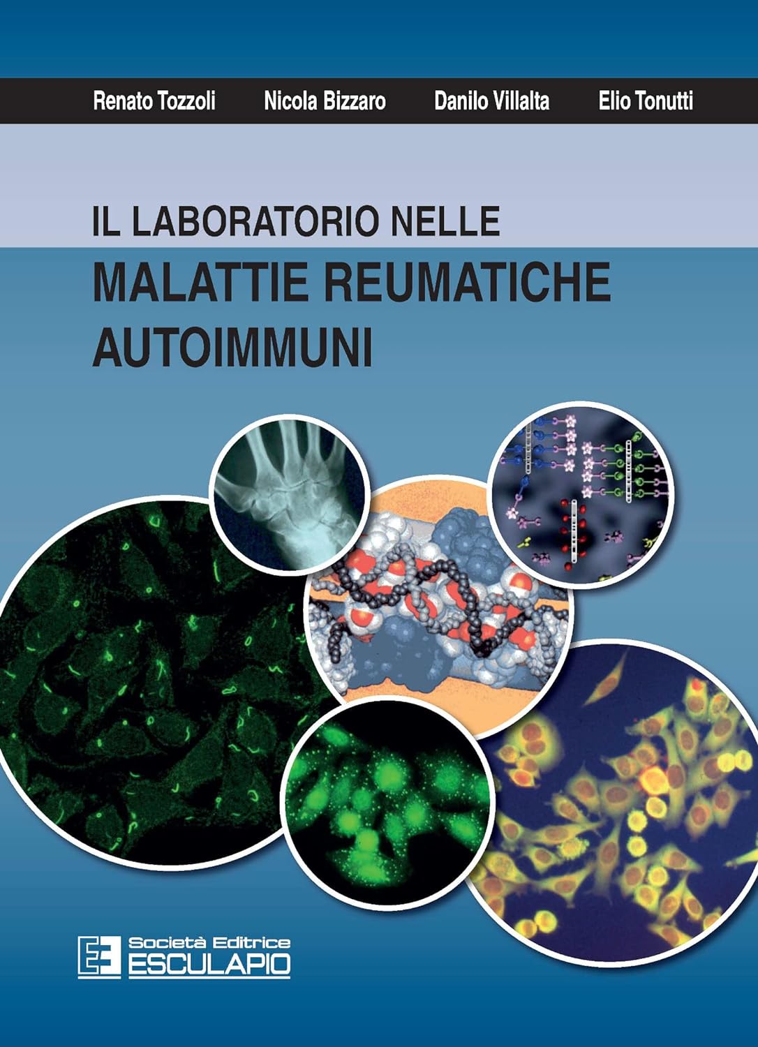 Il laboratorio nelle Malattie Reumatiche Autoimmuni