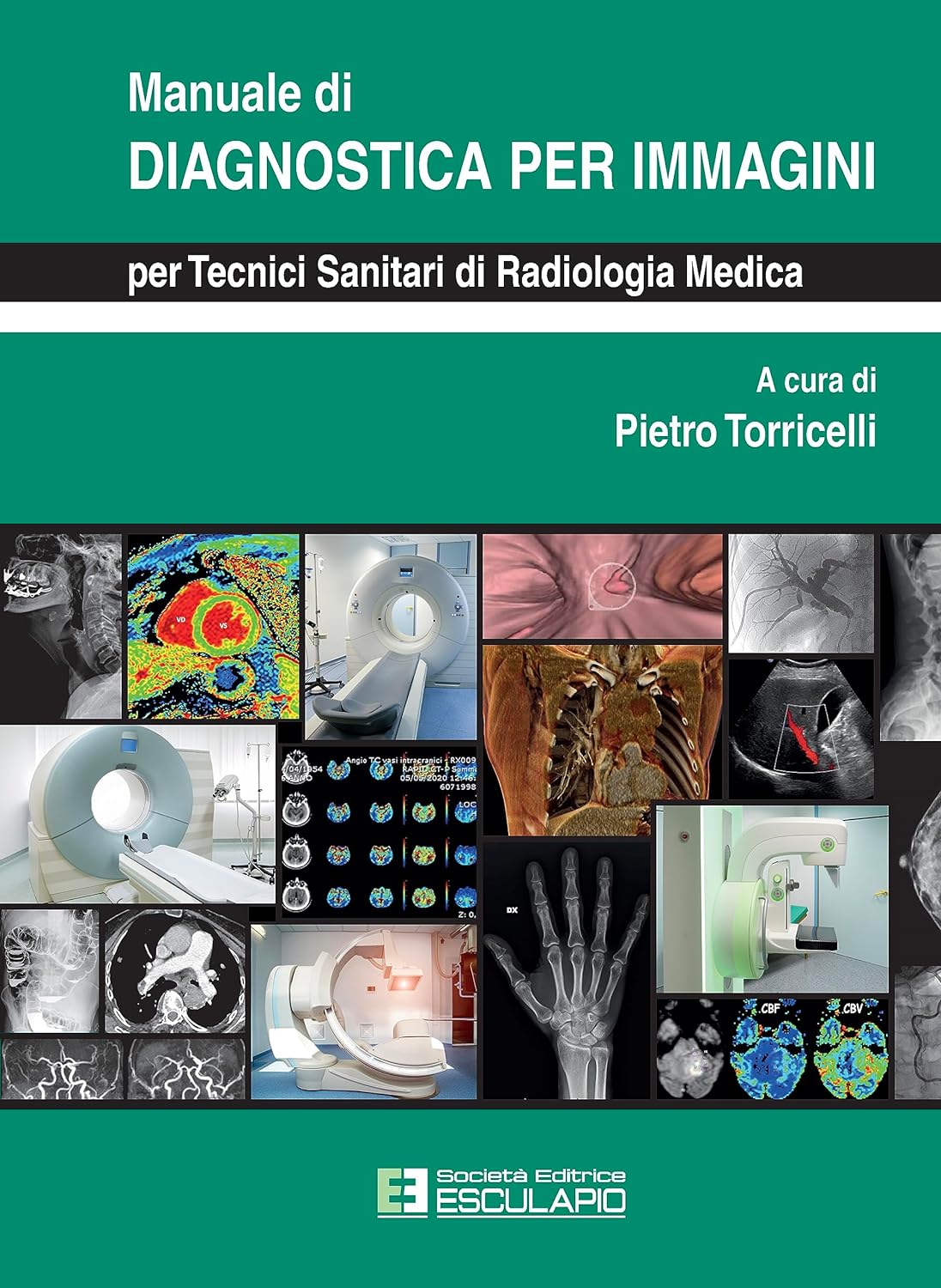 Manuale di Diagnostica per Immagini per Tecnici Sanitari di Radiologia Medica