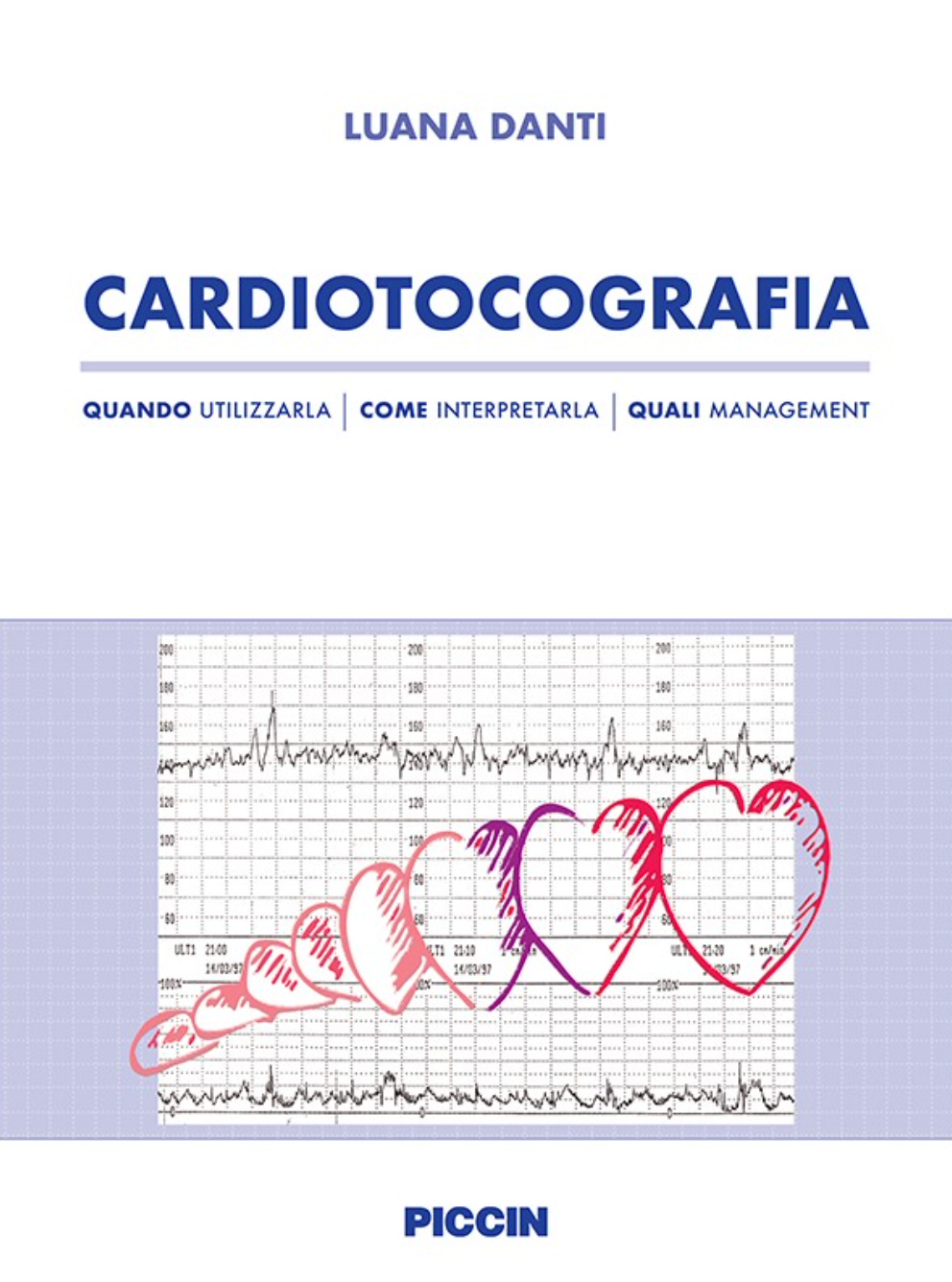 CARDIOTOCOGRAFIA