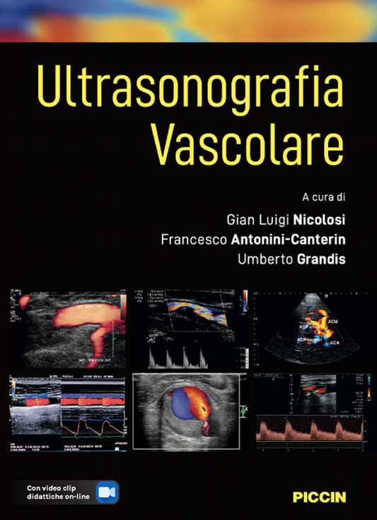 ULTRASONOGRAFIA VASCOLARE