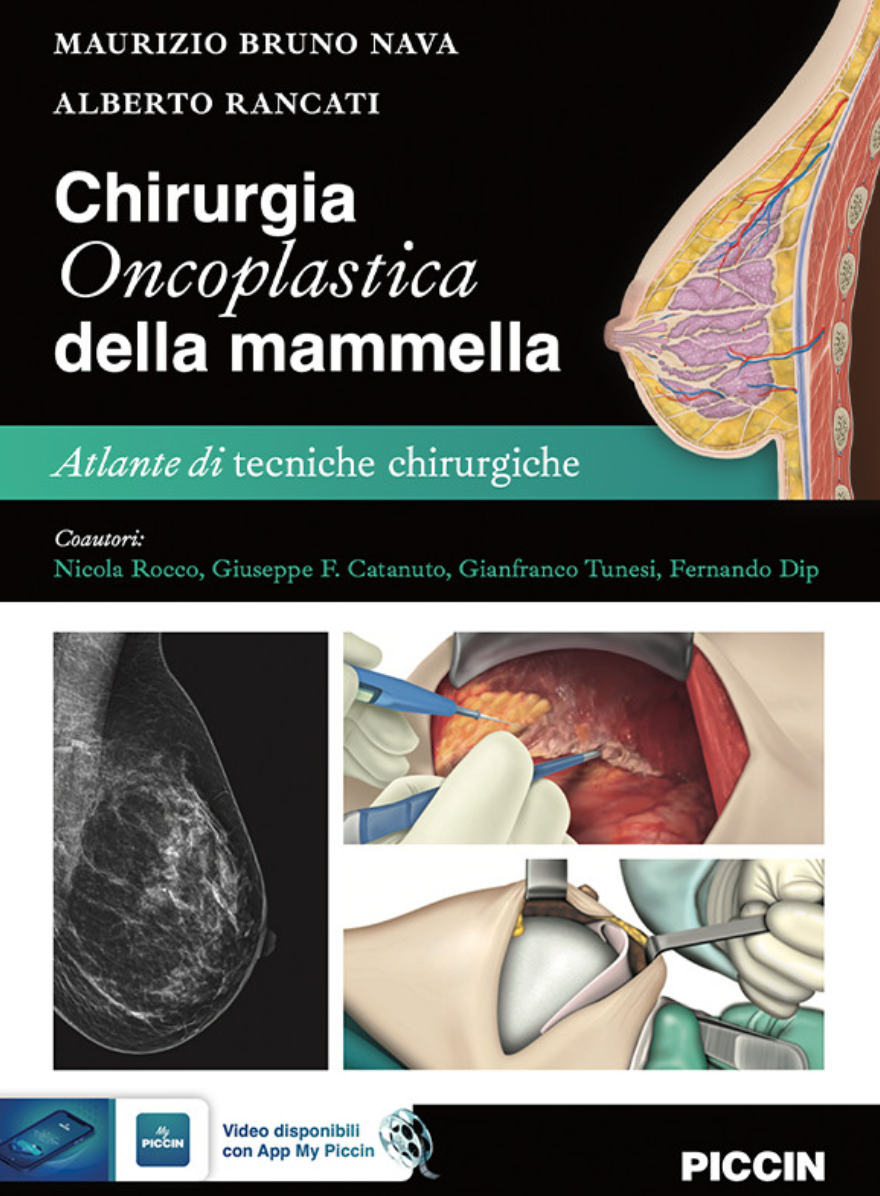 Chirurgia Oncoplastica della Mammella - Atlante di tecniche chirurgiche