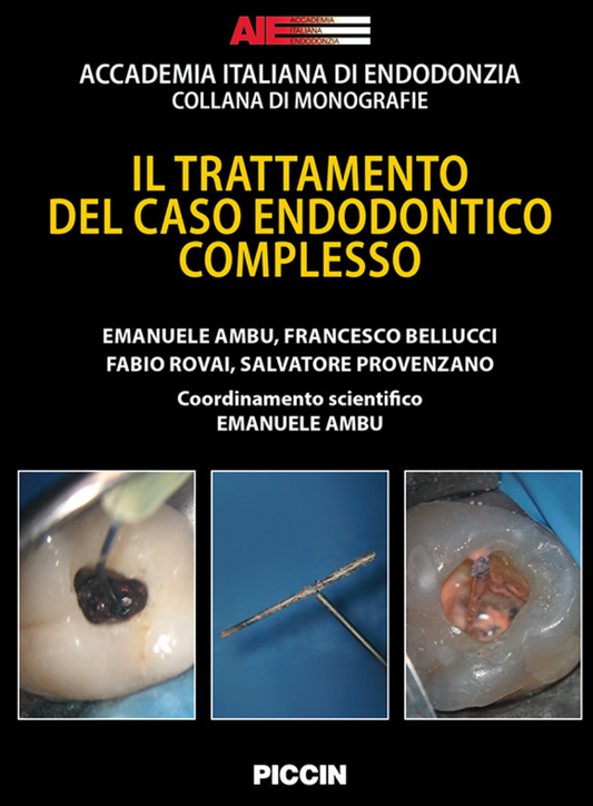 Il trattamento del caso endodontico complesso