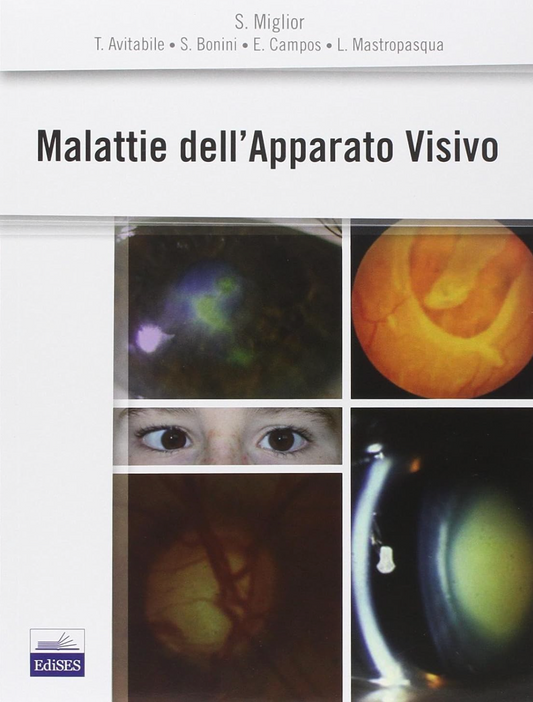 Malattie dell'Apparato Visivo