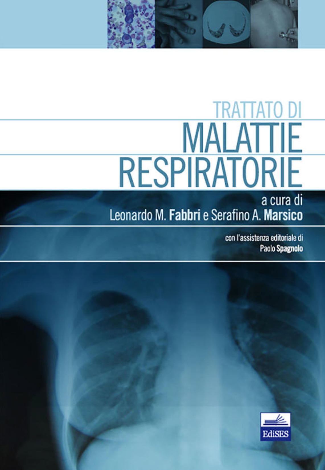 Trattato di Malattie respiratorie