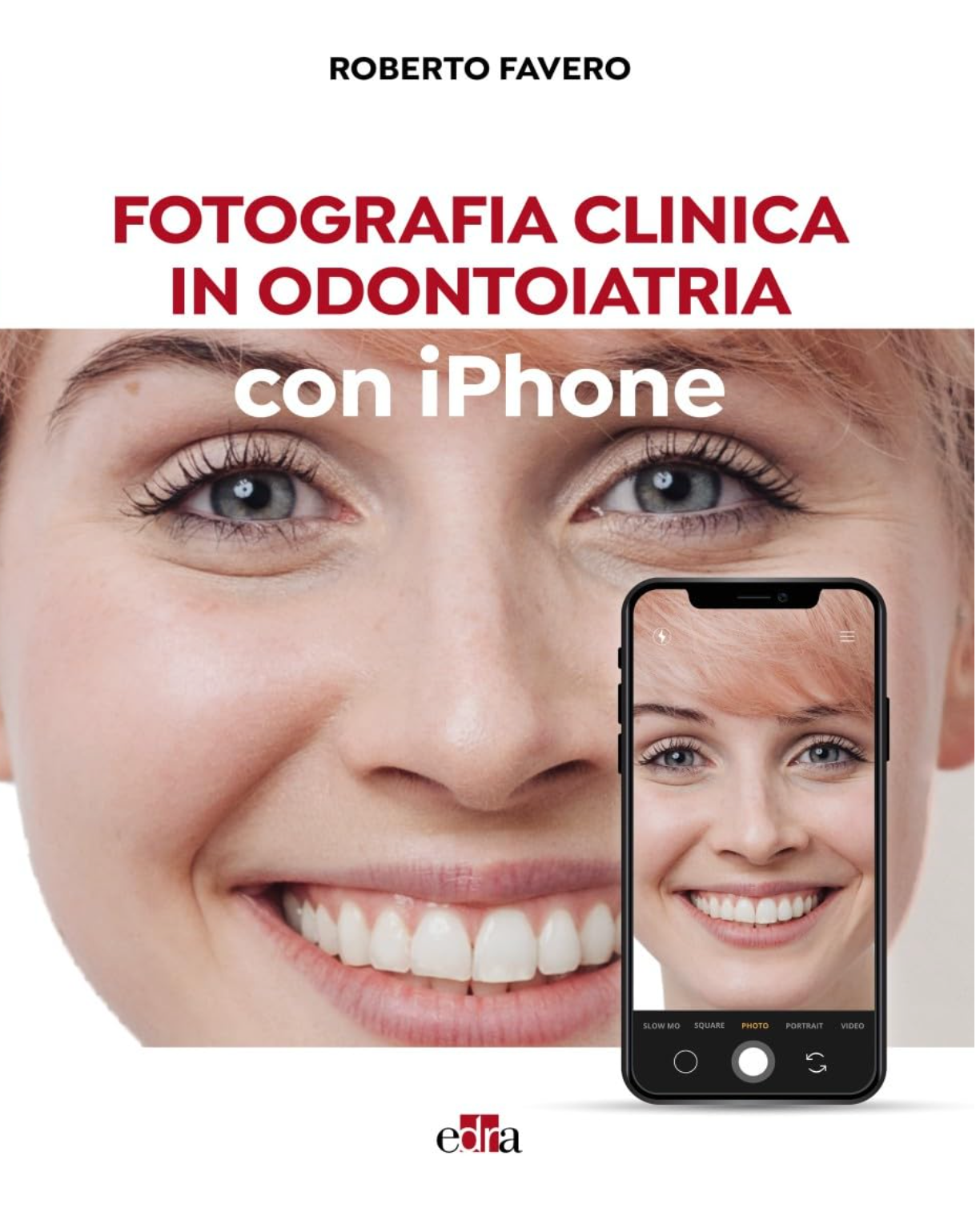 Fotografia clinica in odontoiatira con iPhone