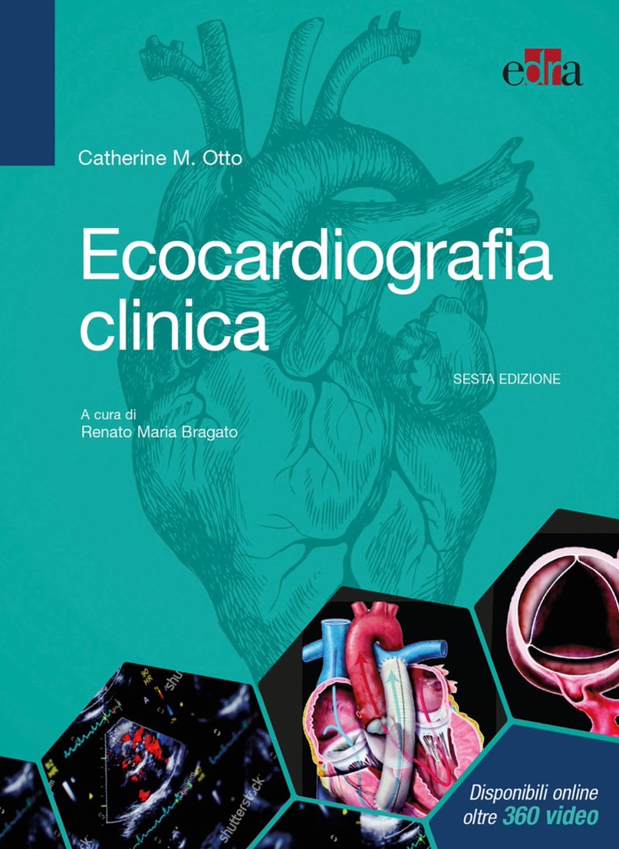 Ecocardiografia clinica