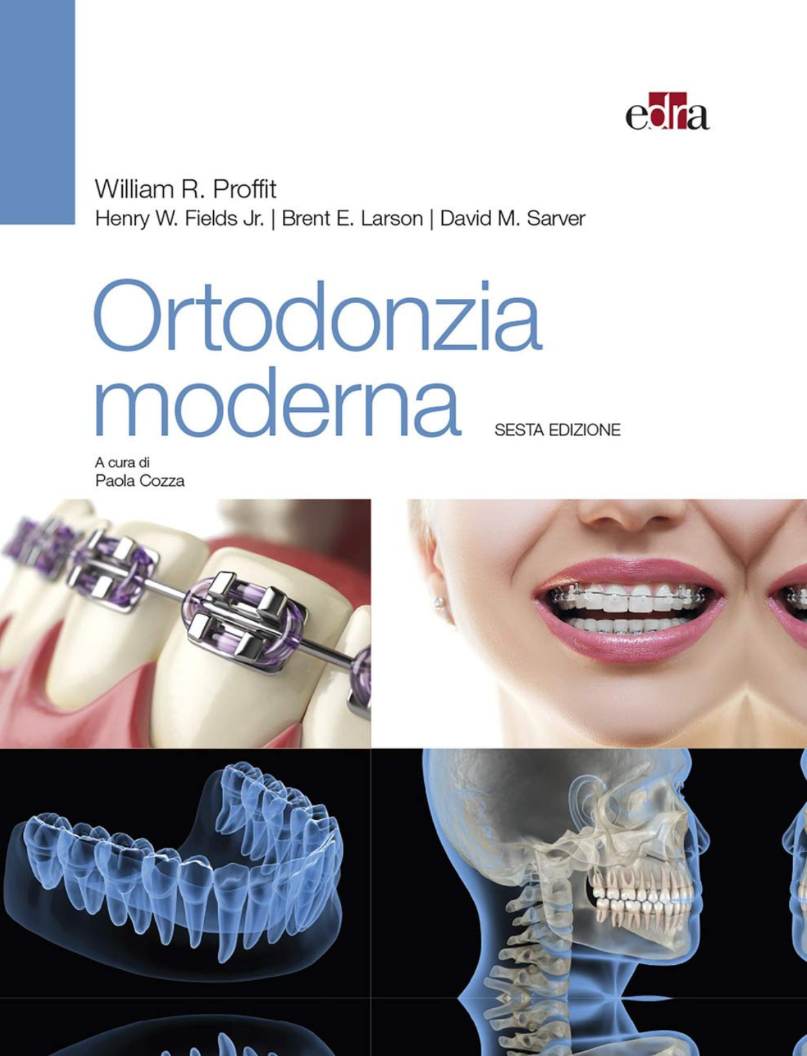 Ortodonzia moderna