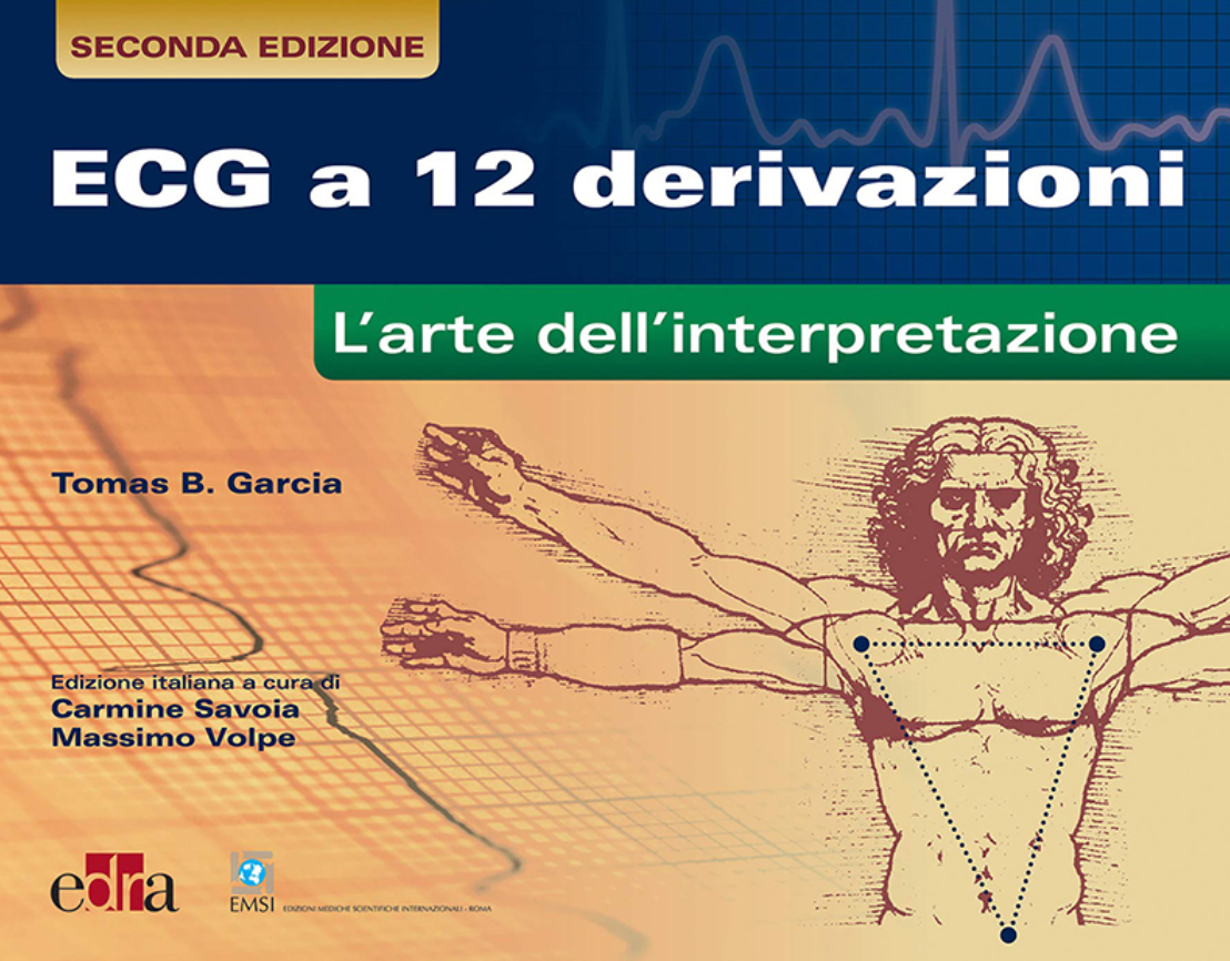 ECG a 12 derivazioni - L' arte dell' interpretazione