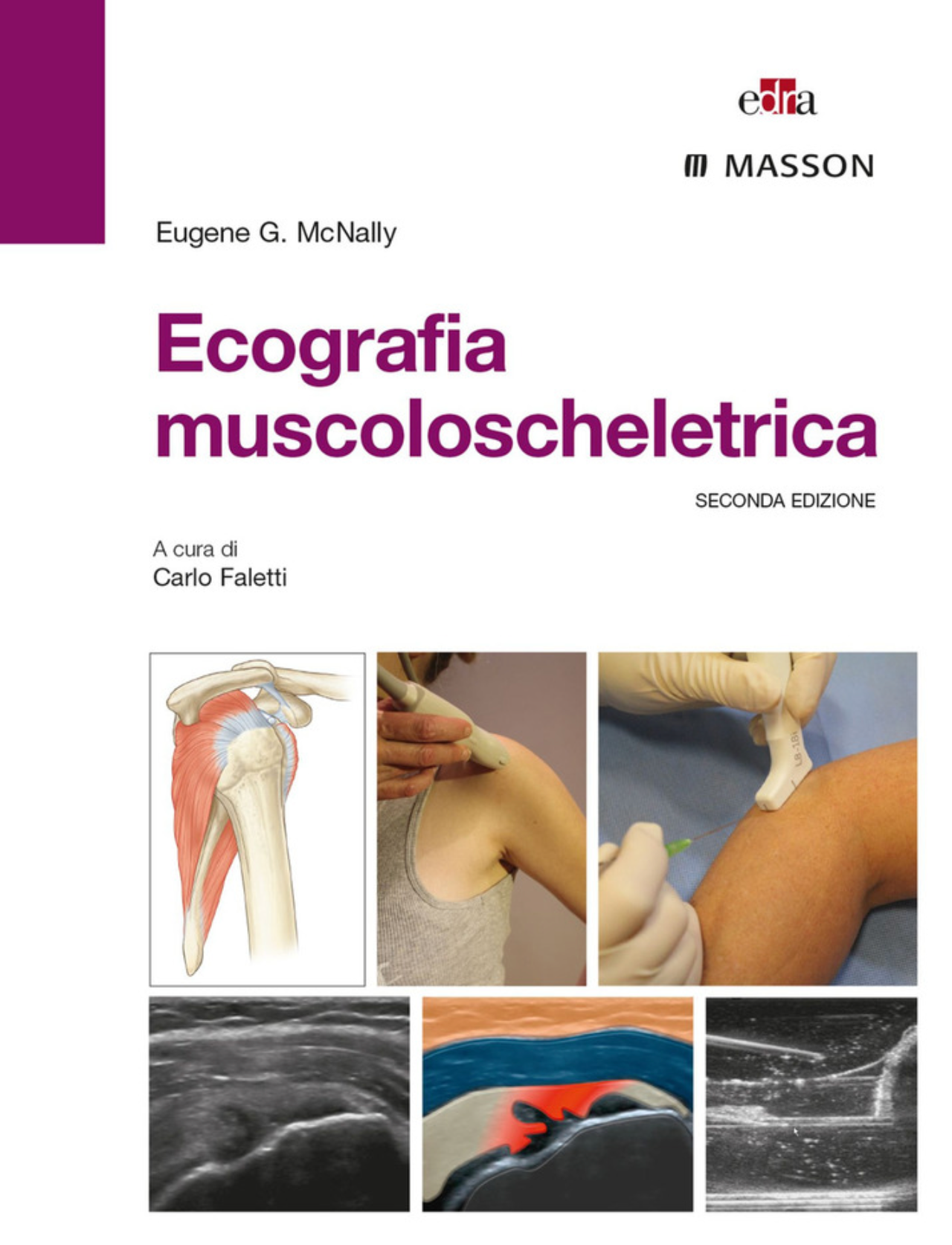 Ecografia muscoloscheletrica - con accesso online incluso