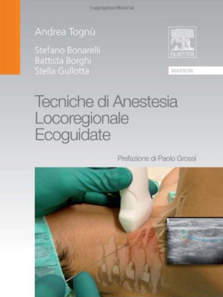 Tecniche di anestesia locoregionale ecoguidate