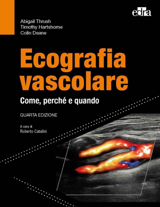 Ecografia vascolare - Come, perchè e quando