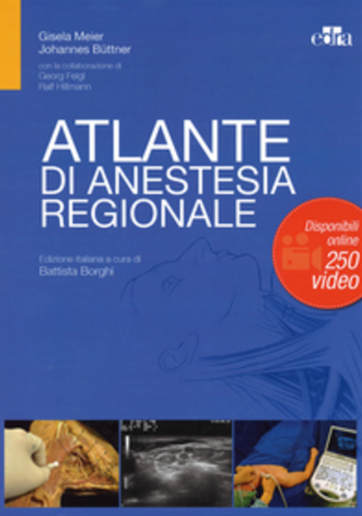 Atlante di anestesia regionale