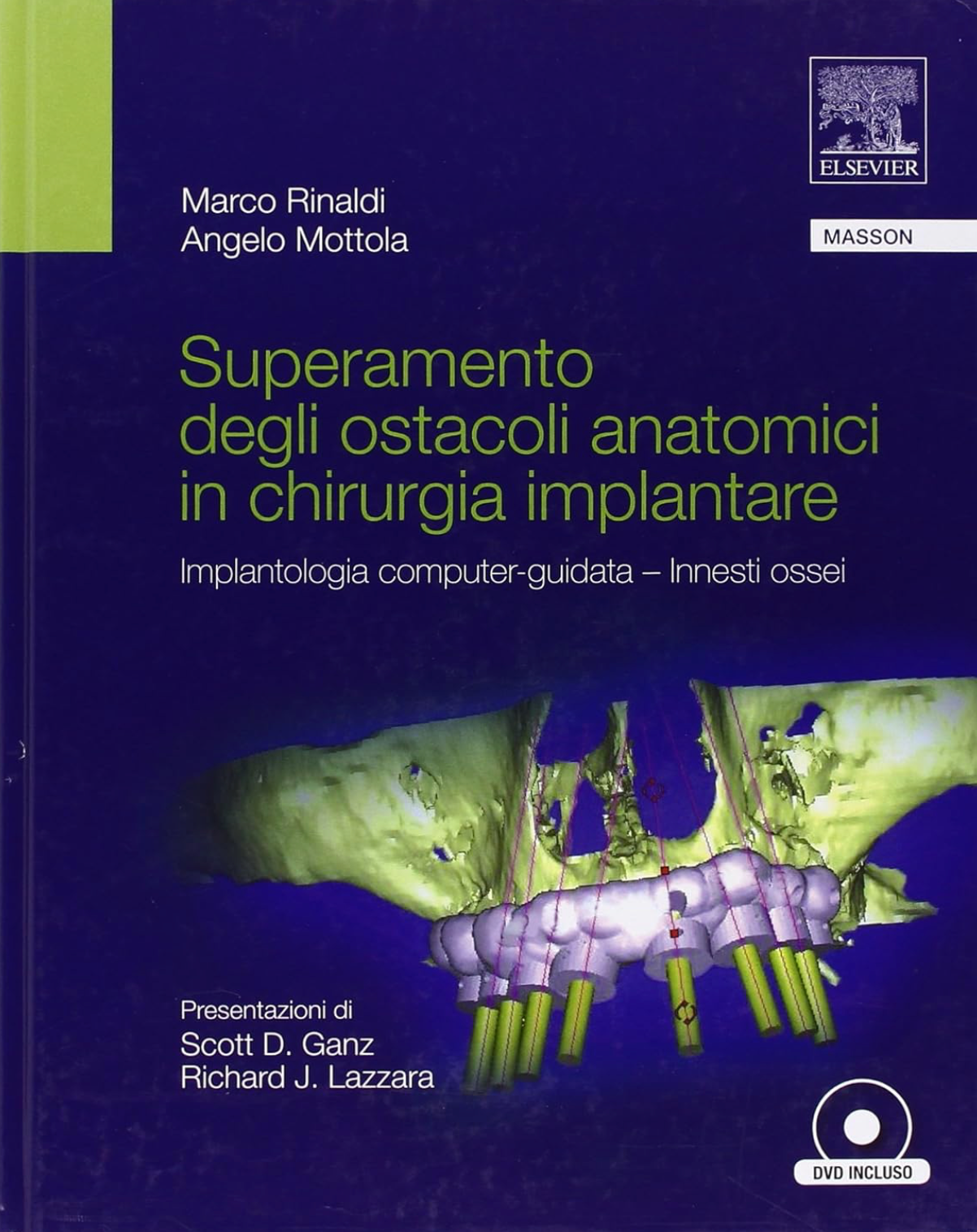 Superamento degli ostacoli anatomici in chirurgia implantare - Implantologia computer - guidata - Innesti ossei