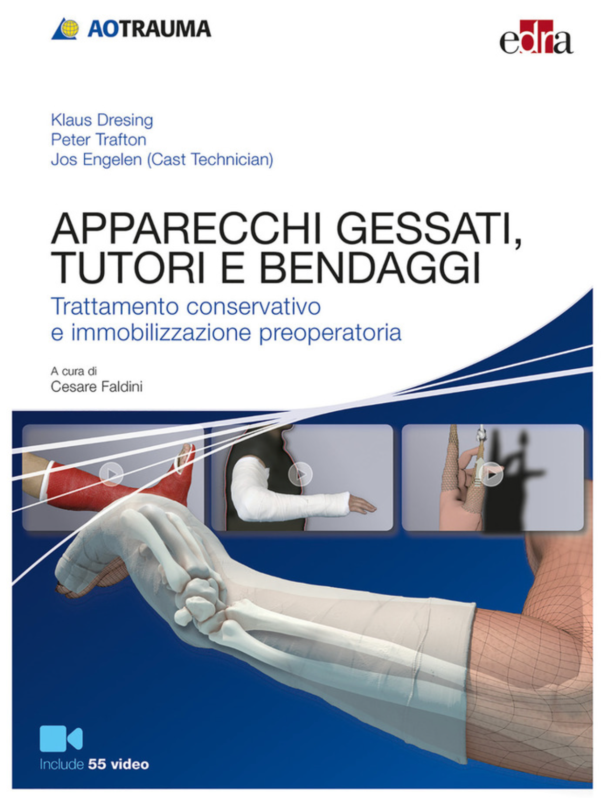 Apparecchi gessati, tutori e bendaggi - Trattamento conservativo e immobilizzazione preoperatoria