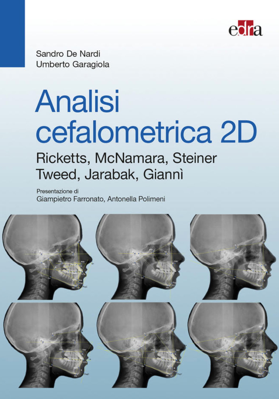 Analisi cefalometrica 2D