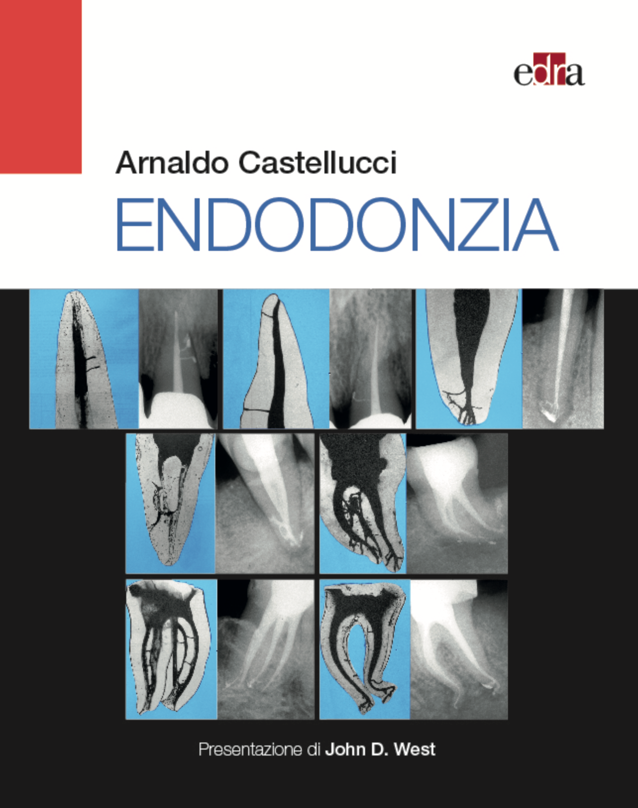 Endodonzia