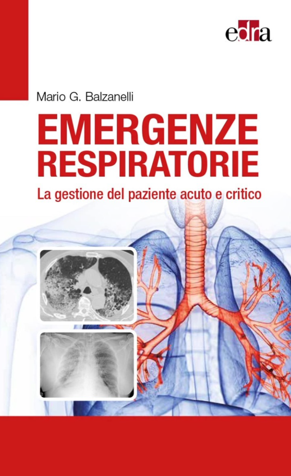 Emergenze respiratorie. La gestione del paziente acuto e critico