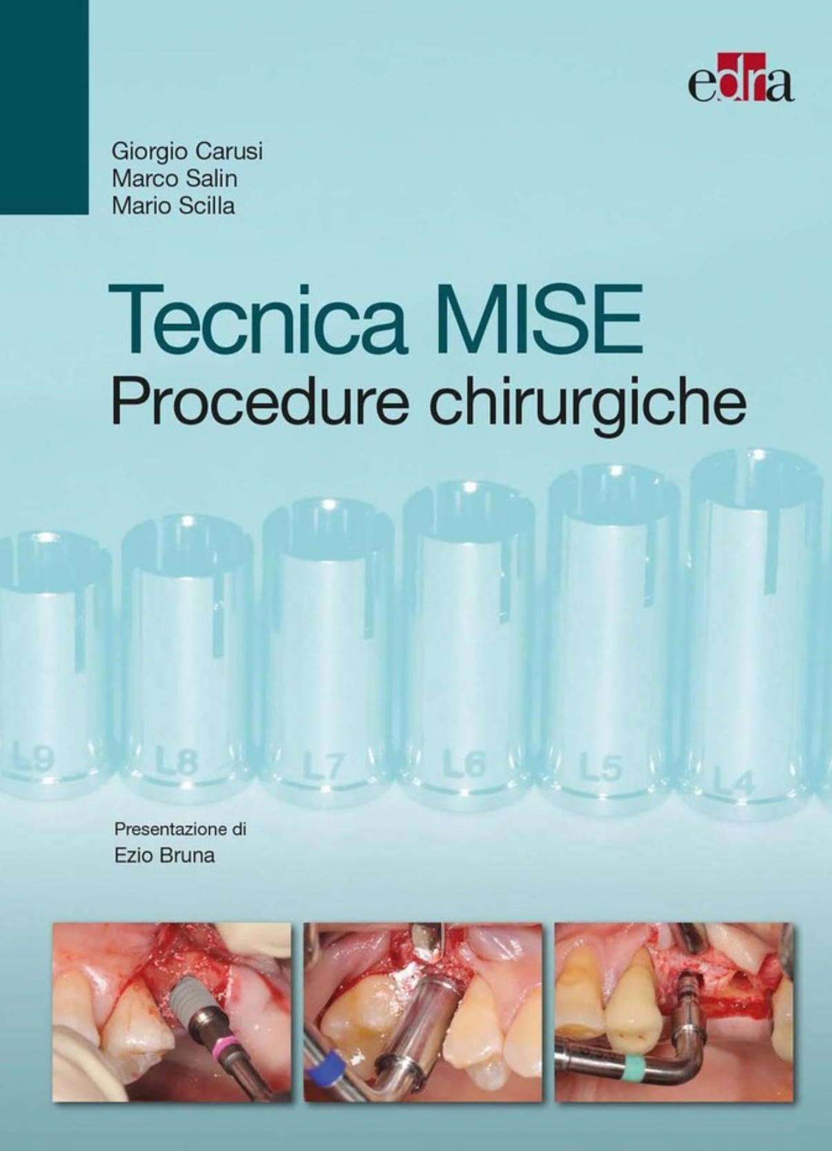 Tecnica MISE - Procedure chirurgiche