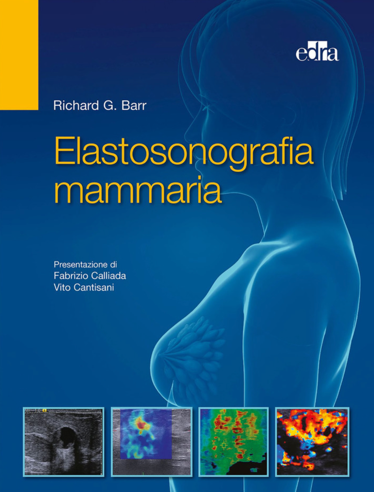 Elastosonografia mammaria