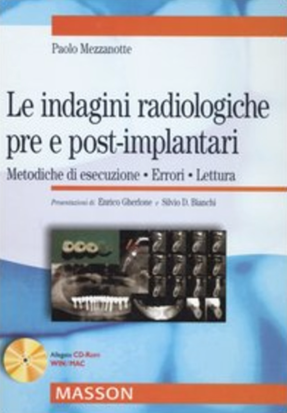 Le indagini radiologiche pre e post - implantari - Metodiche di esecuzione, errori, lettura