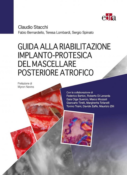 Guida alla riabilitazione implanto - protesica del mascellare posteriore atrofico