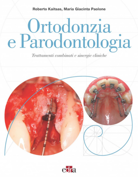 Ortodonzia e Parodontologia - Trattamenti combinati e sinergie cliniche