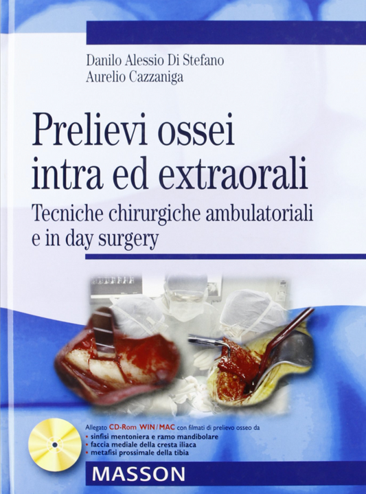 Prelievi ossei intra ed extraorali - Tecniche chirurgiche ambulatoriali e in day surgery