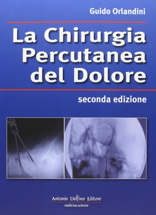 La chirurgia percutanea del dolore