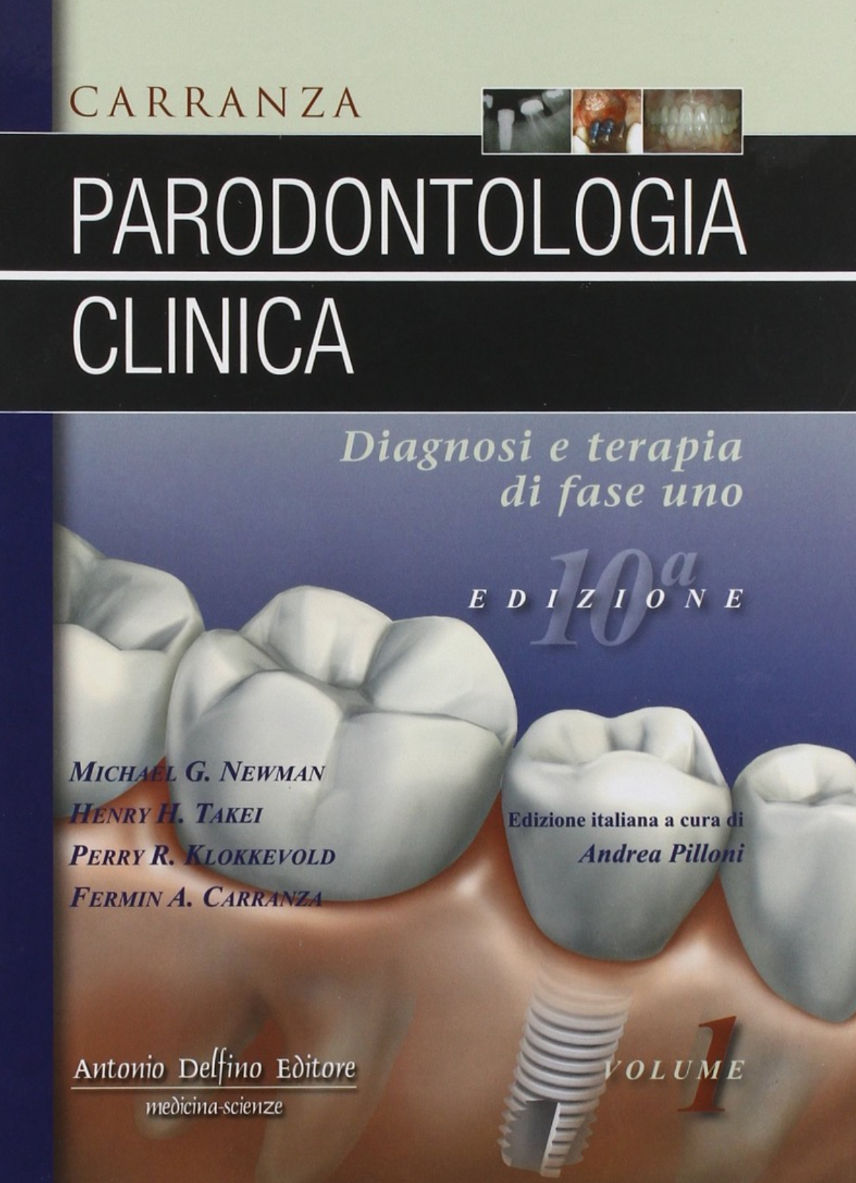 Parodontologia clinica: Diagnosi e terapia di fase uno