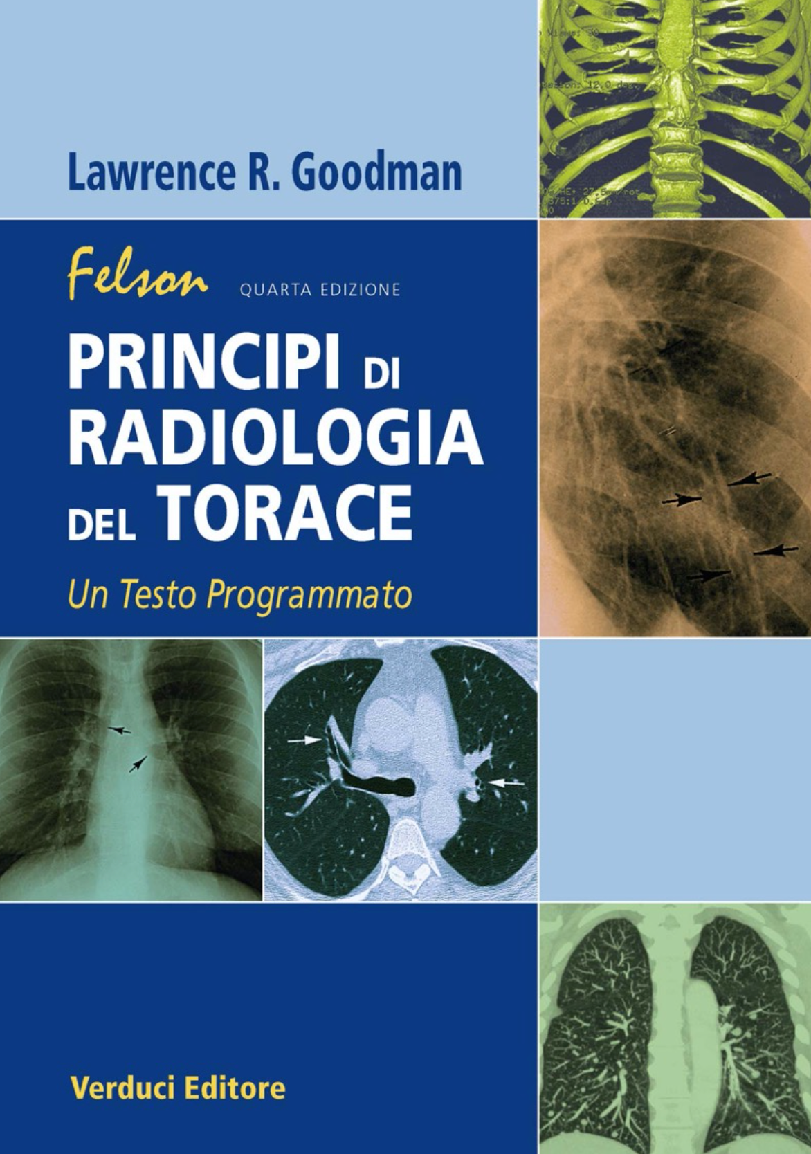 Felson - Principi di radiologia del torace