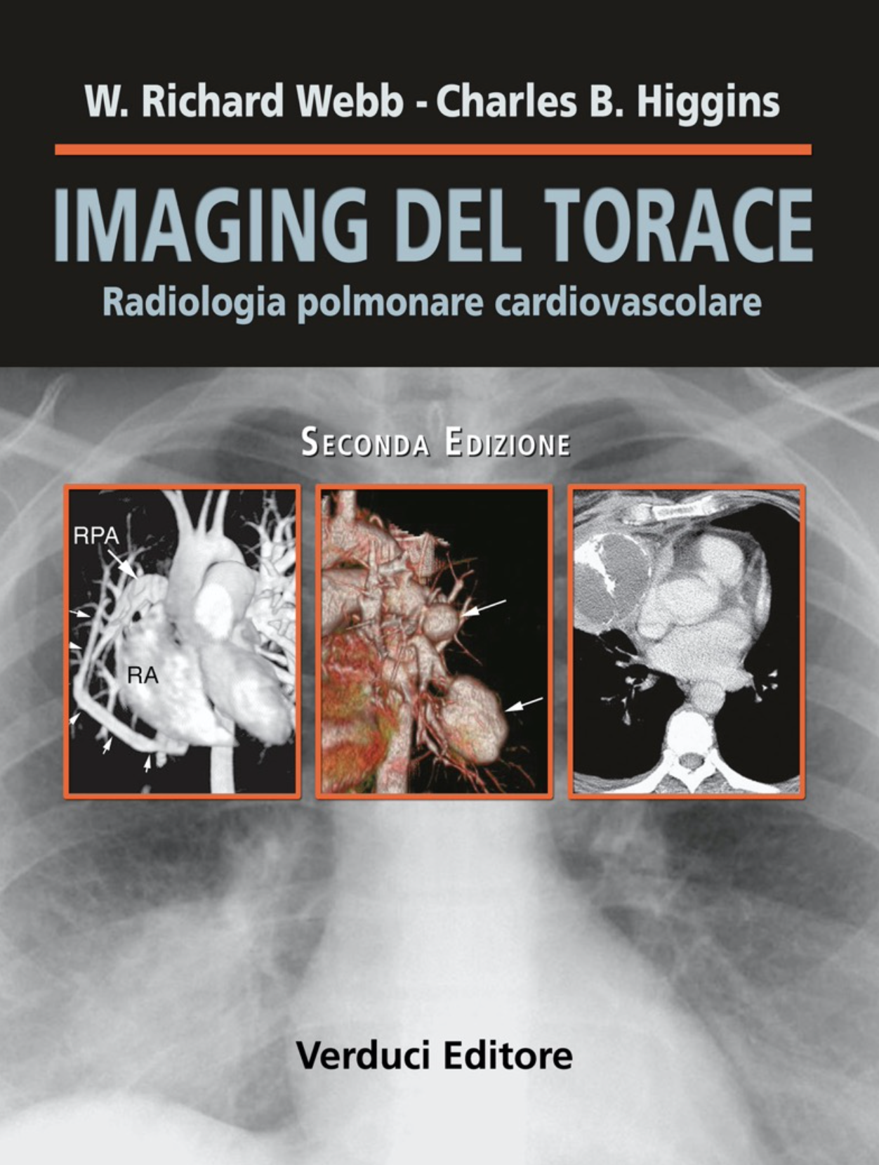 Imaging torace - Radiologia Polmonare e Cardiovascolare