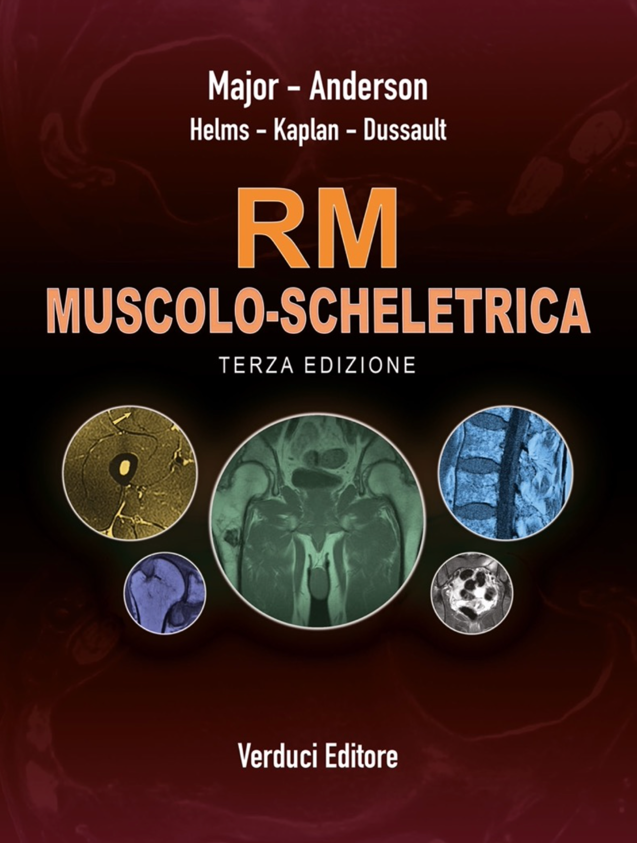 RM muscolo-scheletrica