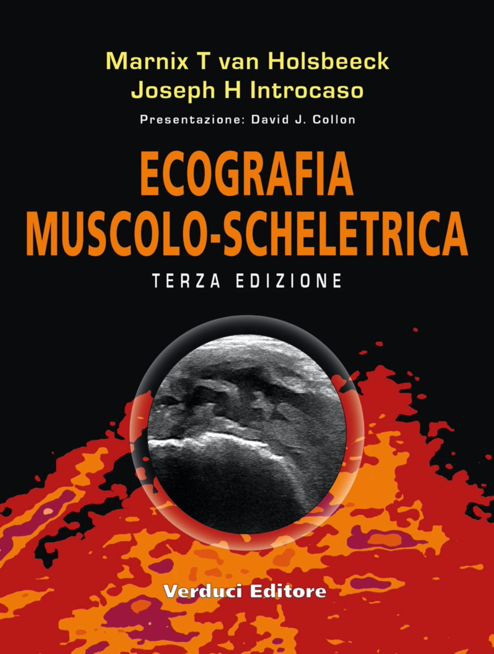 Ecografia Muscolo Scheletrica