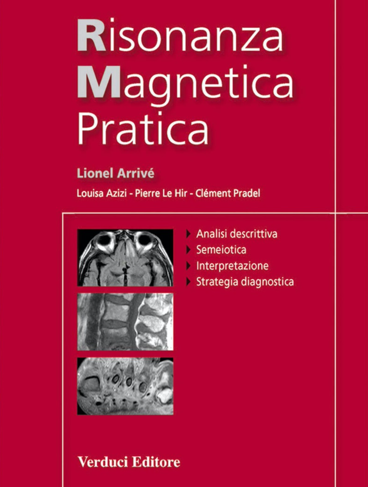 Risonanza Magnetica Pratica (RM)