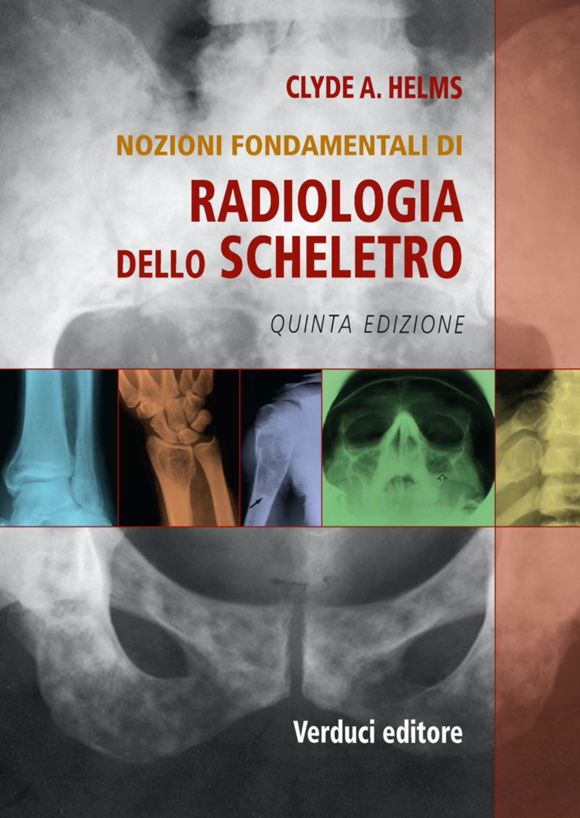 Nozioni fondamentali di radiologia dello scheletro