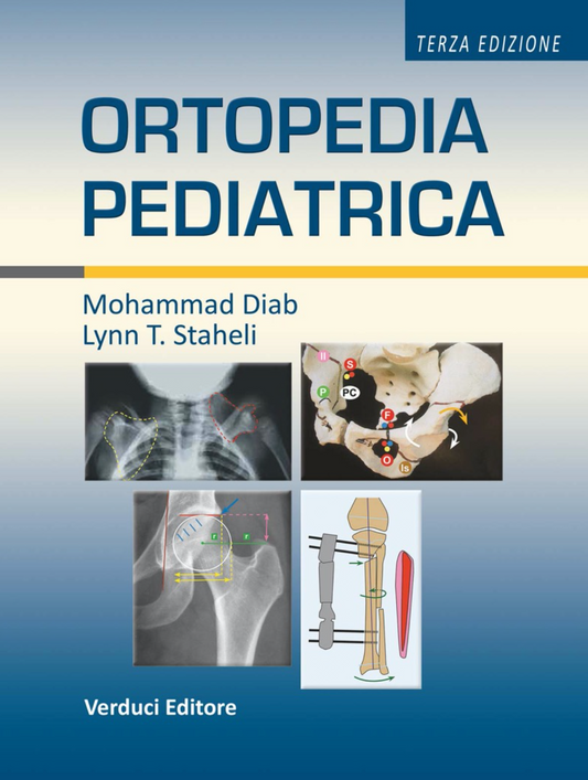 Ortopedia pediatrica