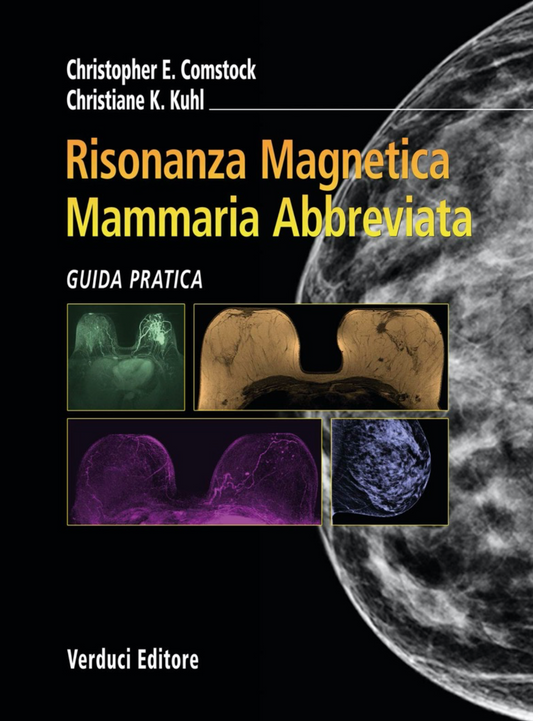 Risonanza Magnetica Mammaria Abbreviata - Guida Pratica