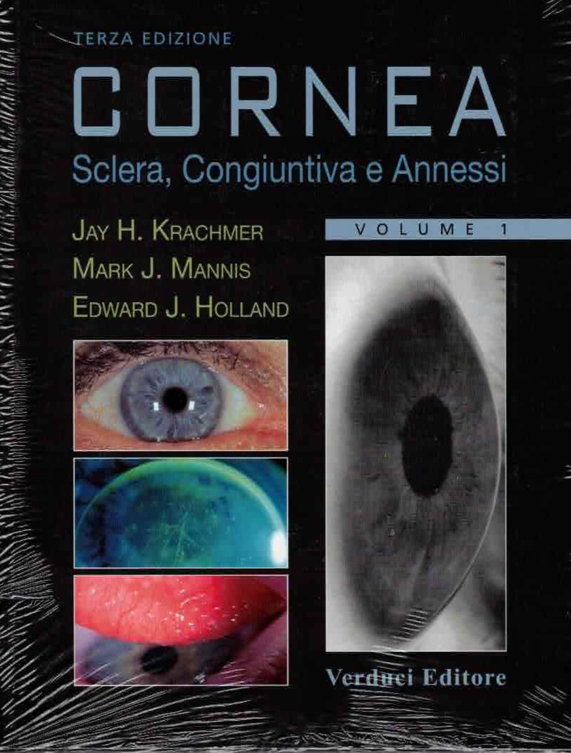 Cornea - Sclera, Congiuntiva e Annessi