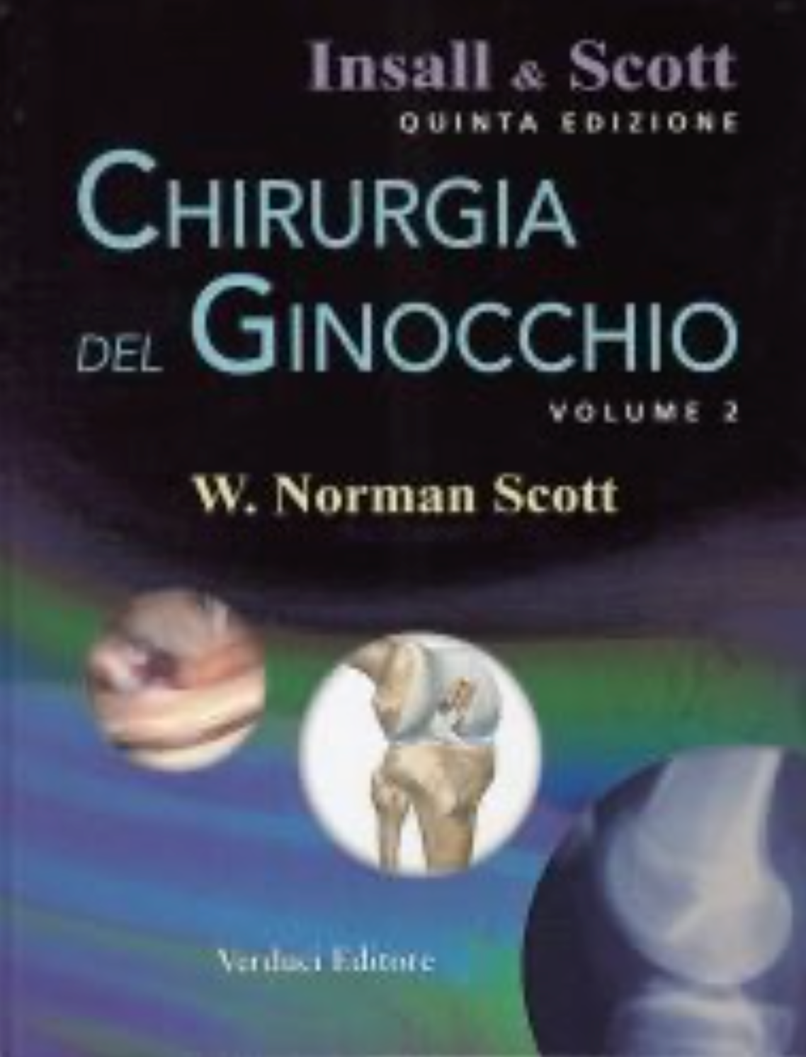 Chirurgia del ginocchio - Volume 2