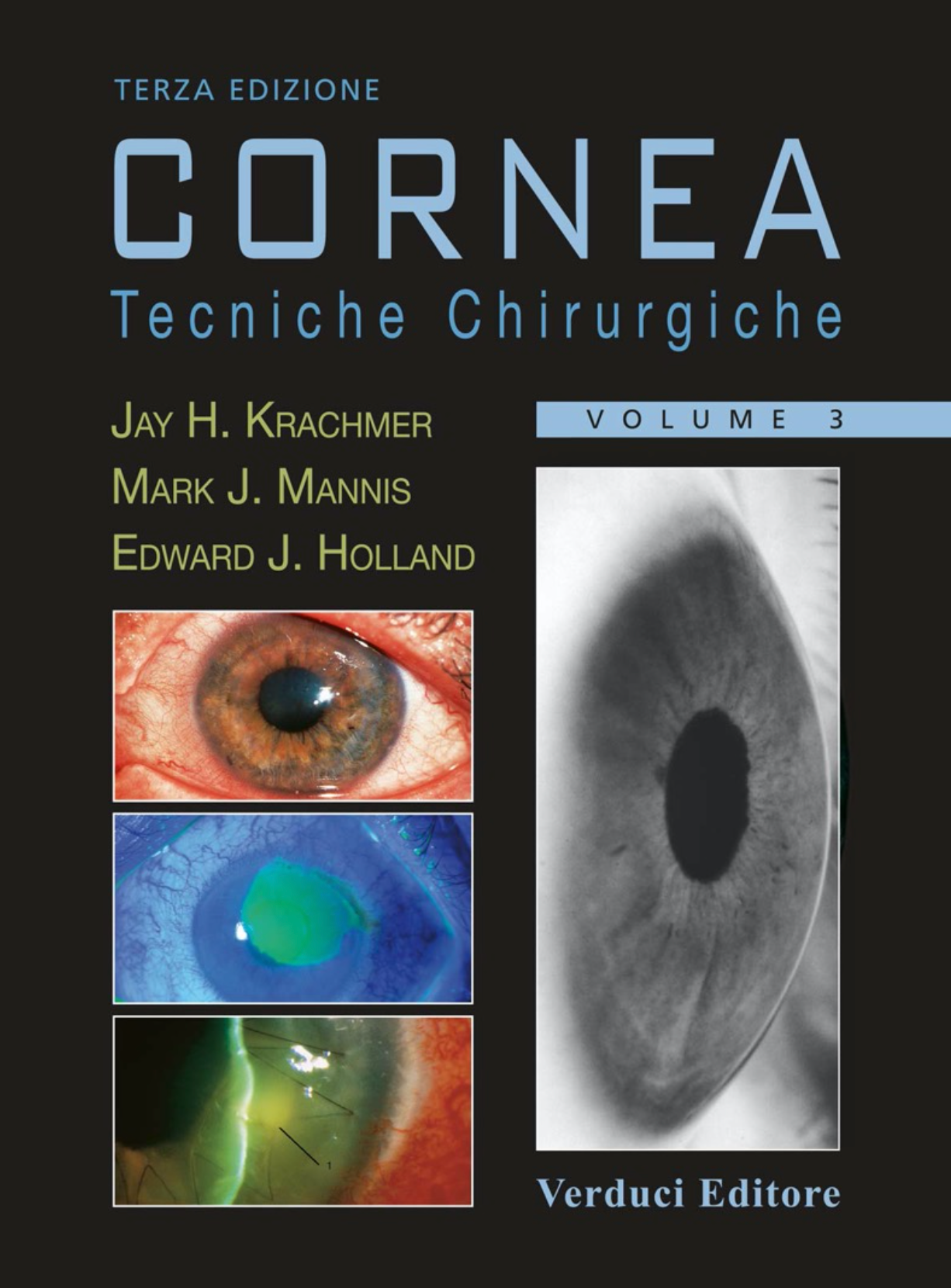 Cornea - Tecniche Chirurgiche