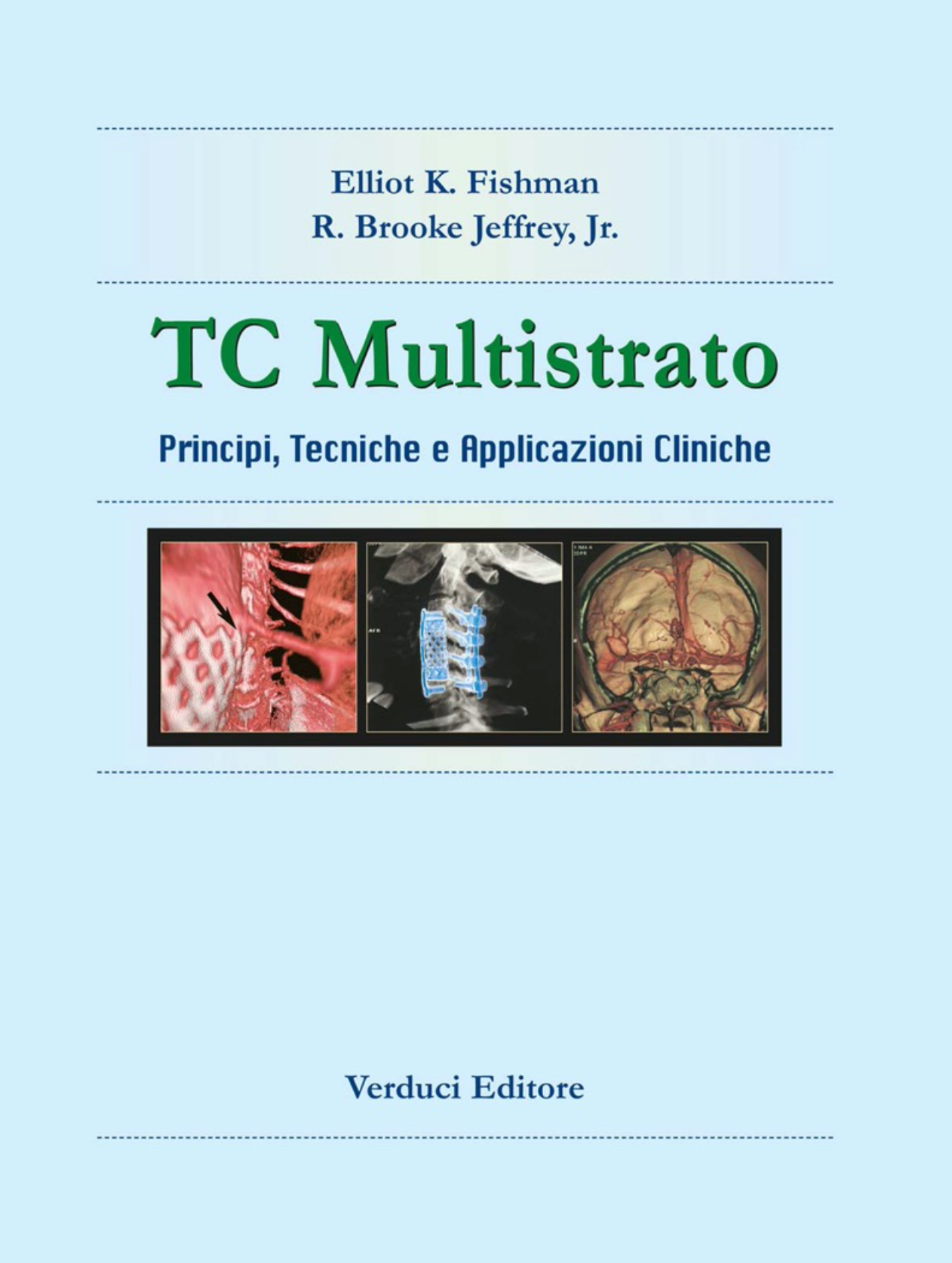 TC multistrato. Principi, tecniche e applicazioni cliniche