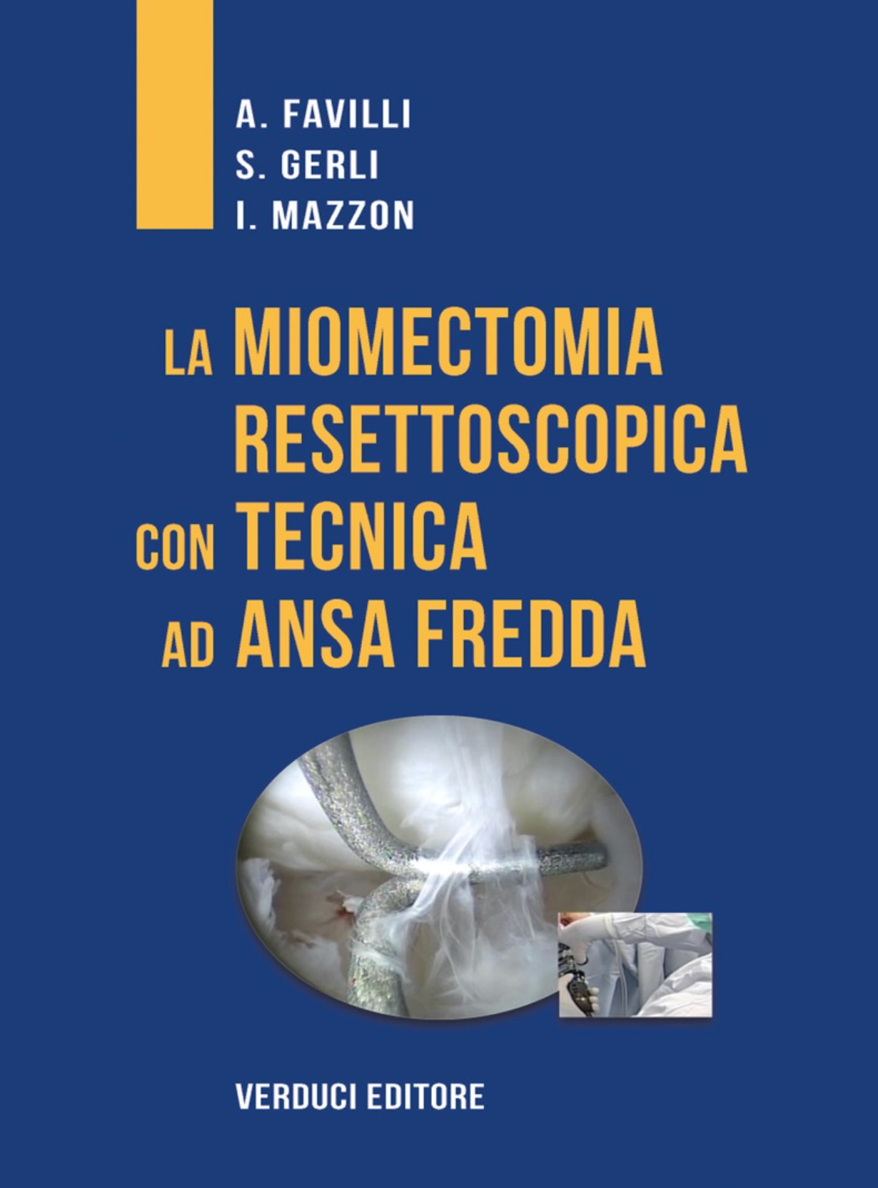 La Miomectomia Resettoscopica con Tecnica ad Ansa Fredda