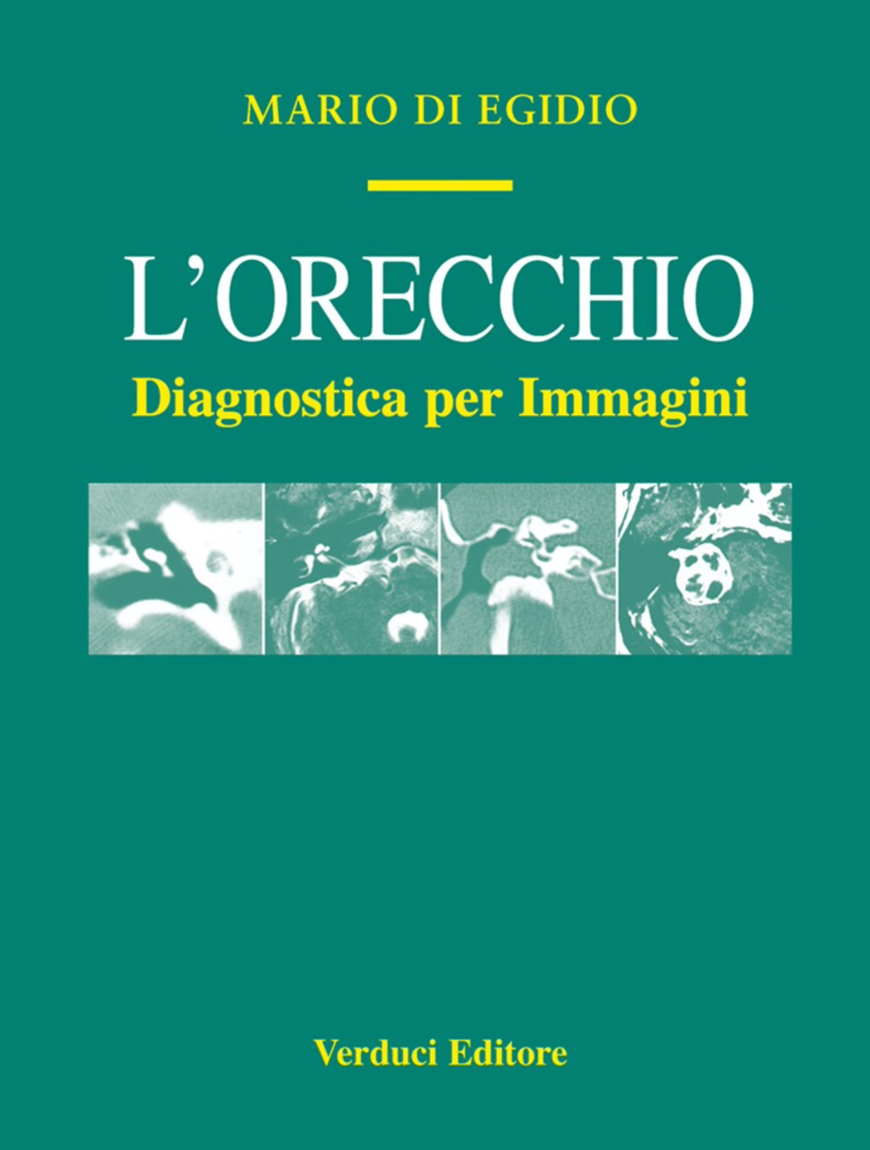 L'orecchio - Diagnostica per immagini