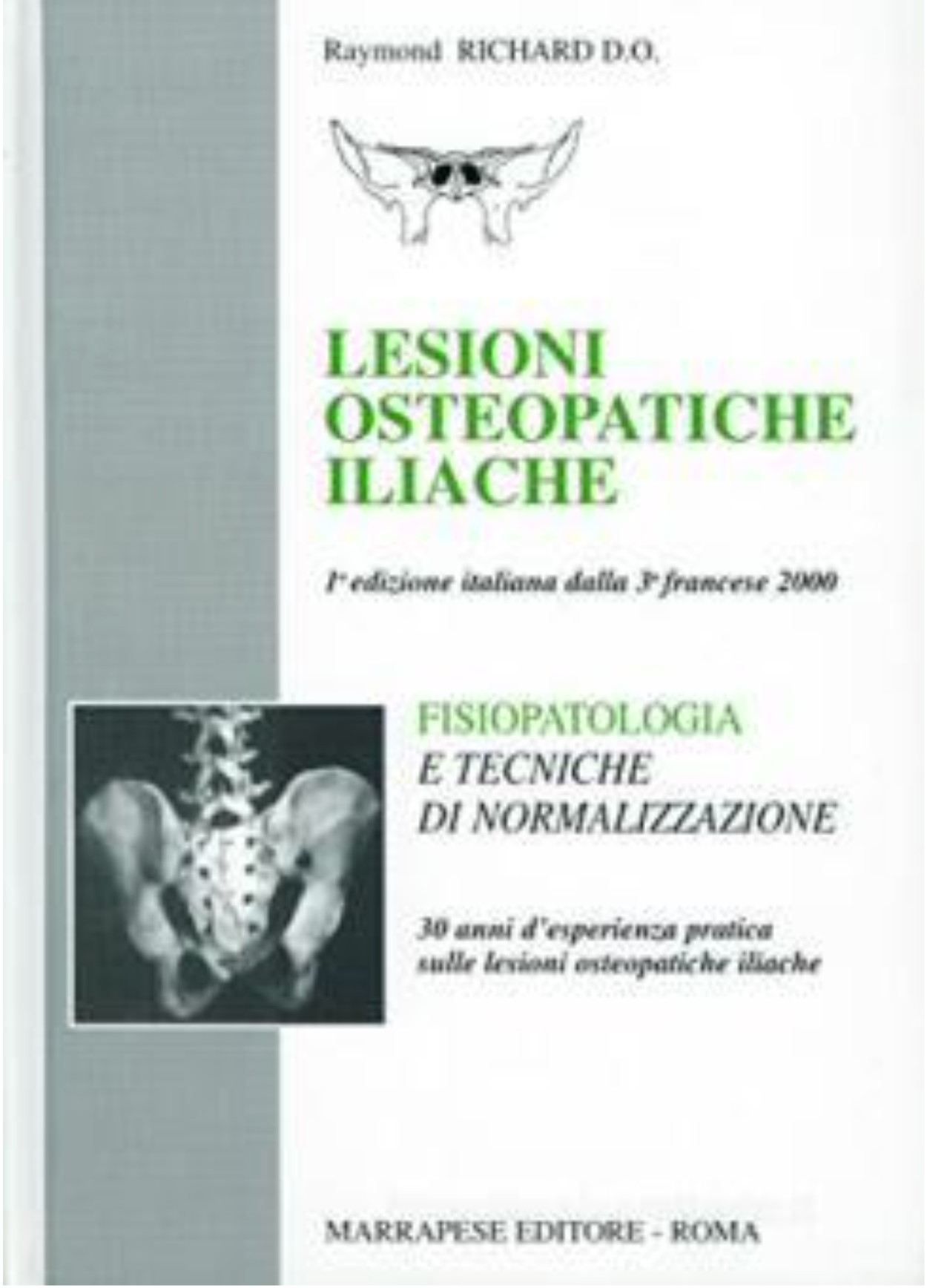 Lesioni osteopatiche iliache. Fisiopatologia e tecniche di normalizzazione