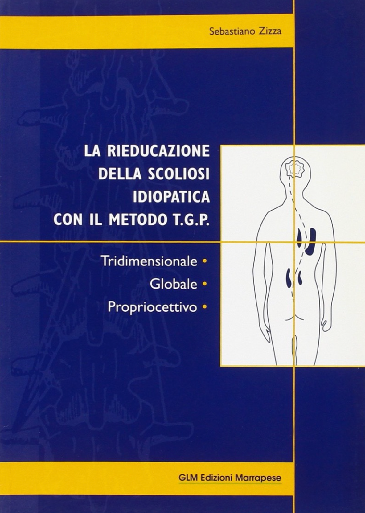 La rieducazione della scoliosi idiopatica con il metodo T.G.P. - Tridimensionale - Globale - Propriocettivo